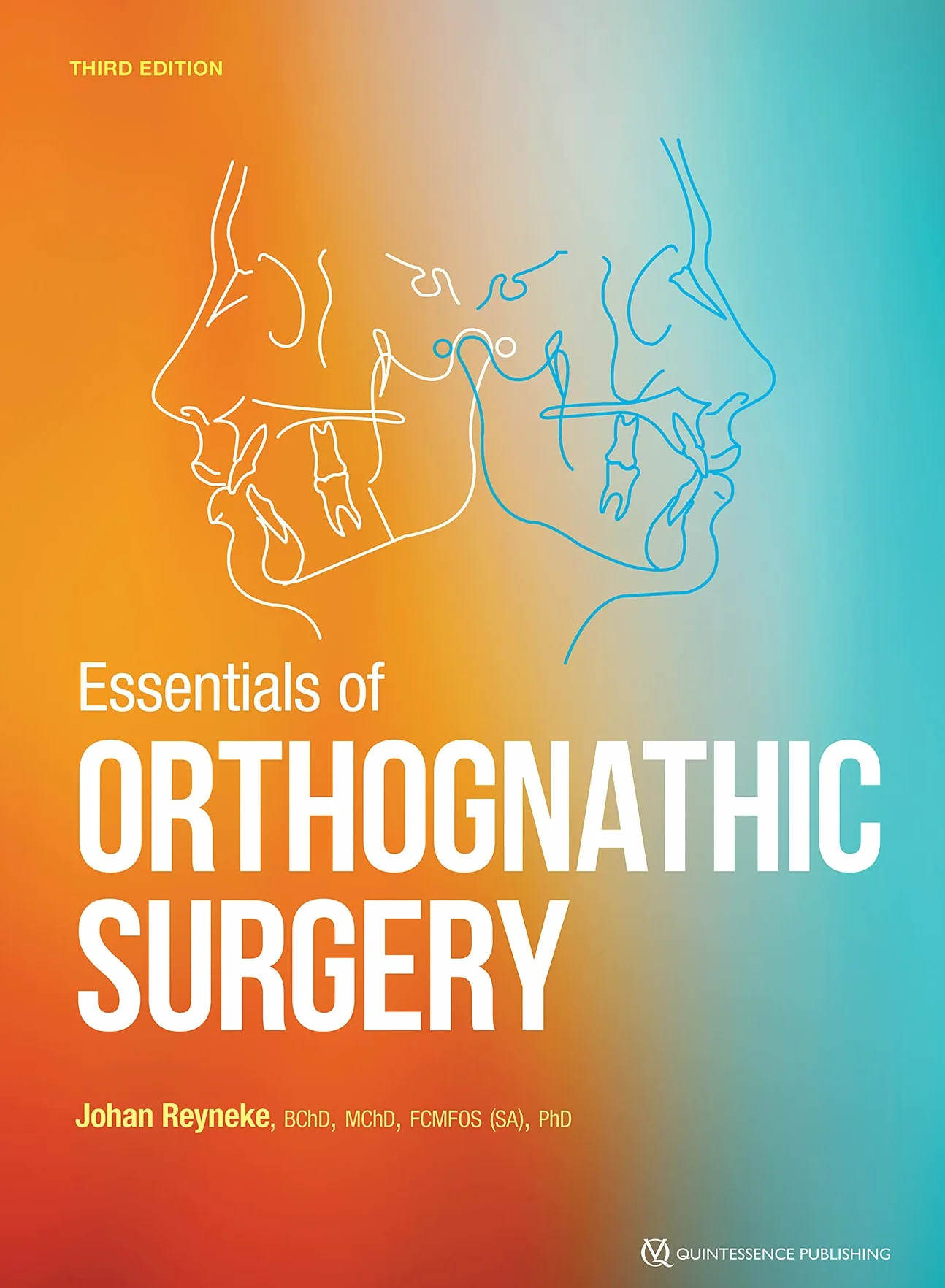 Essentials of Orthognathic Surgery