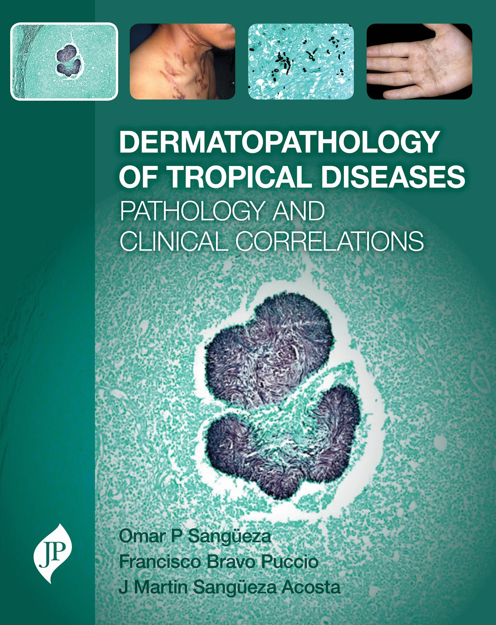 Dermatopathology of Tropical Diseases: Pathology and Clinical Correlations