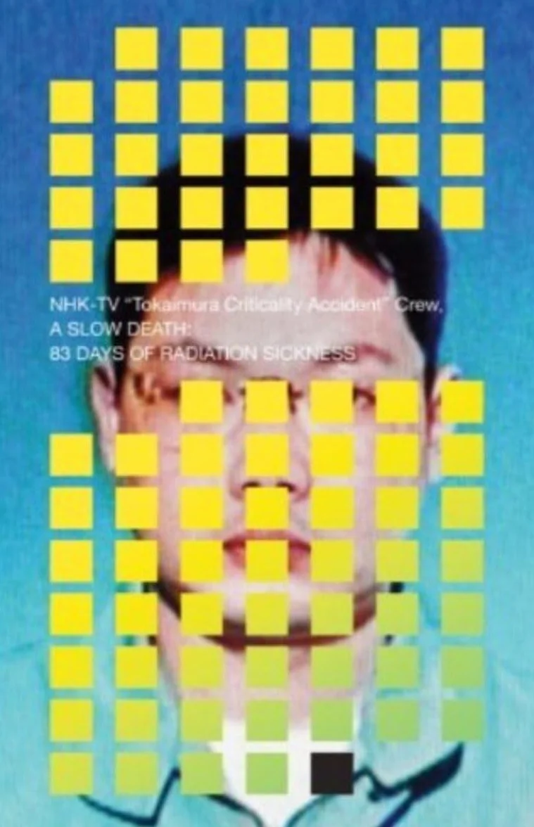 A Slow Death: 83 Days of Radiation Sickness