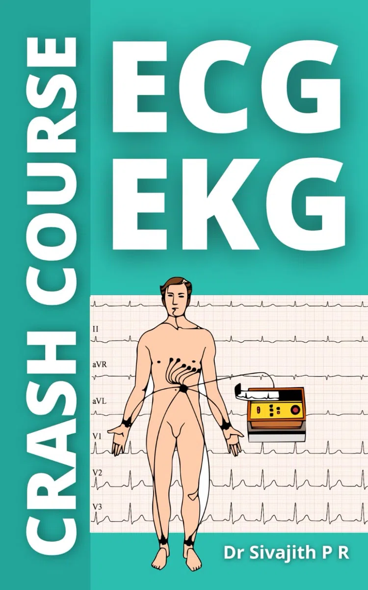 ECG / EKG Crash Course: ECG Interpretation Made Easy – A Step-by-Step Guide to Learning 12-Lead ECG Interpretation, Arrhythmias, and Cardiovascular Emergencies