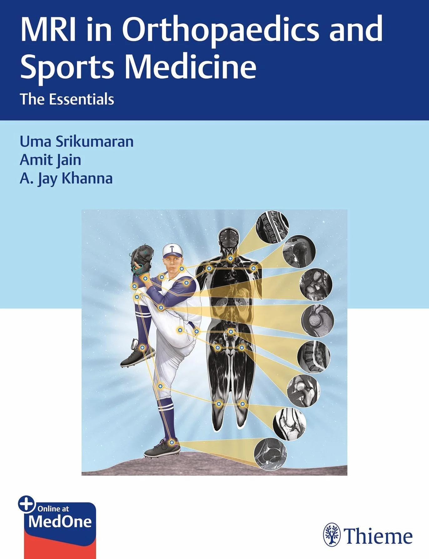 MRI in Orthopaedics and Sports Medicine: The Essentials