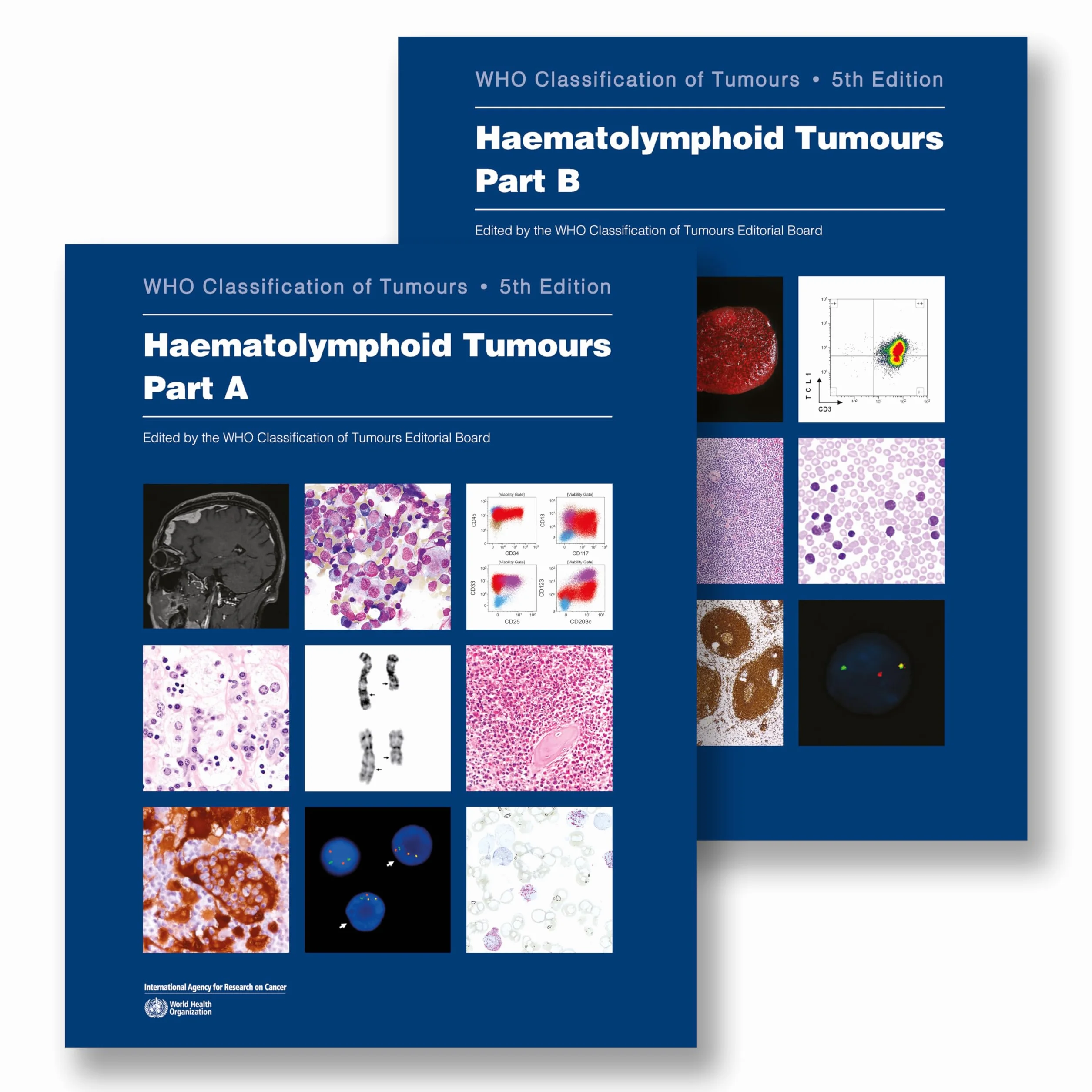 Haematolymphoid Tumours: Who Classification of Tumours