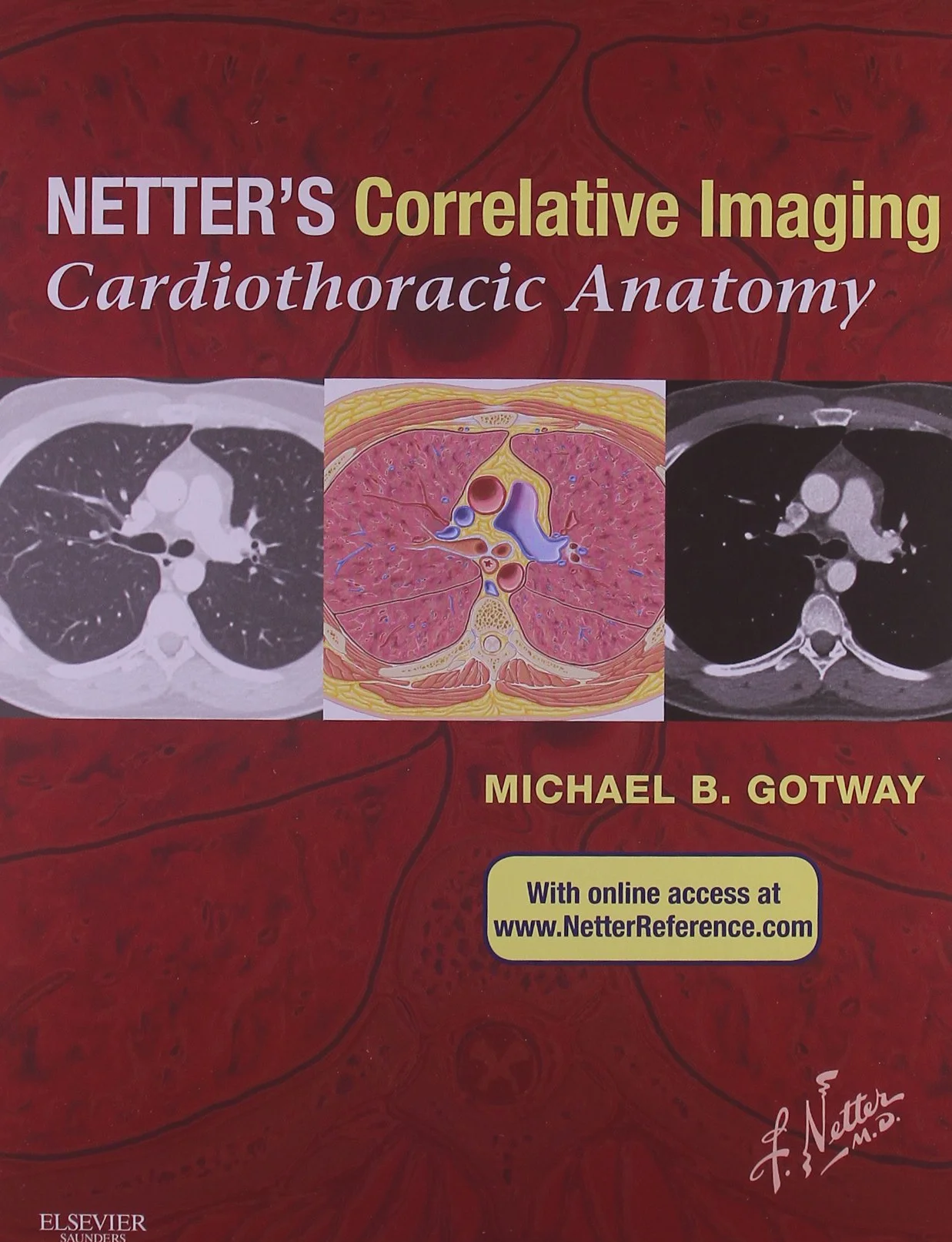 Netter's Correlative Imaging: Cardiothoracic Anatomy: With Online Access at Www.Netterreference.com