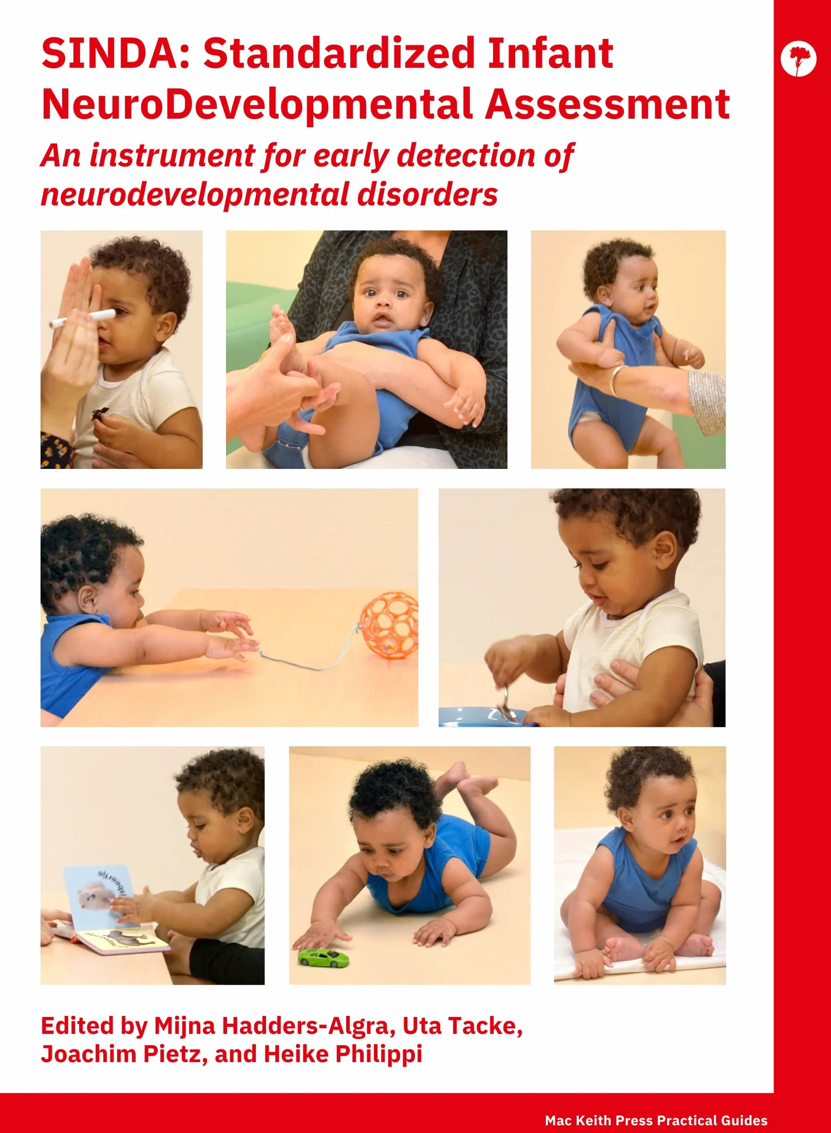 Sinda Standardized Infant Neurodevelopmental Assessment: An Instrument for Early Detection of Neurodevelopmental Disorders