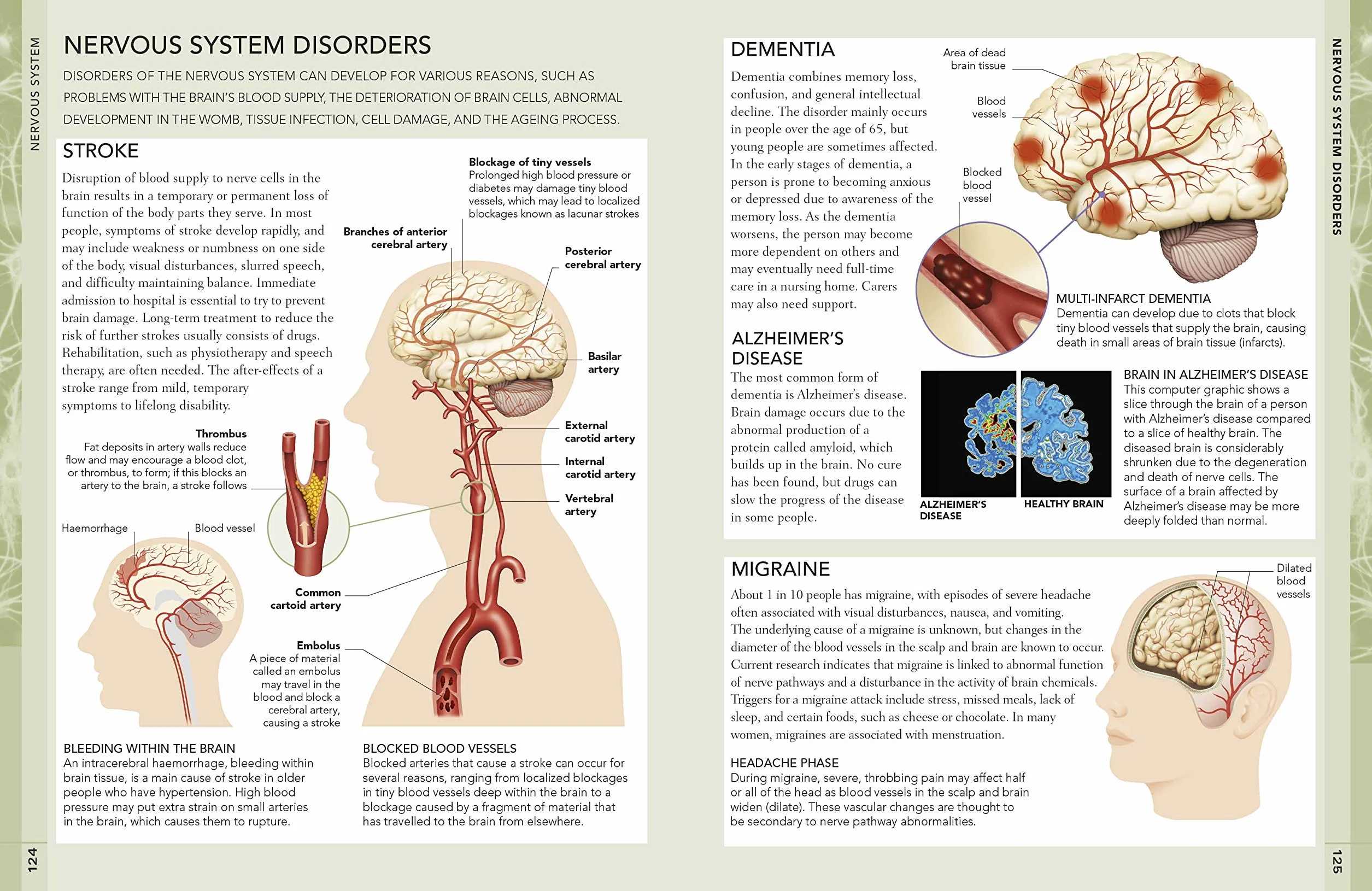 The Concise Human Body Book: An illustrated guide to its structure, function and disorders