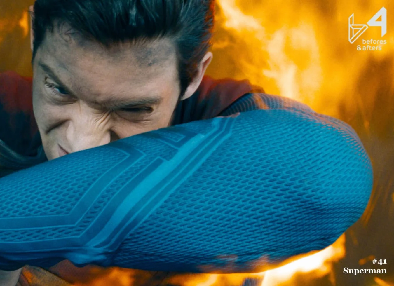 befores & afters - #41 - Superman