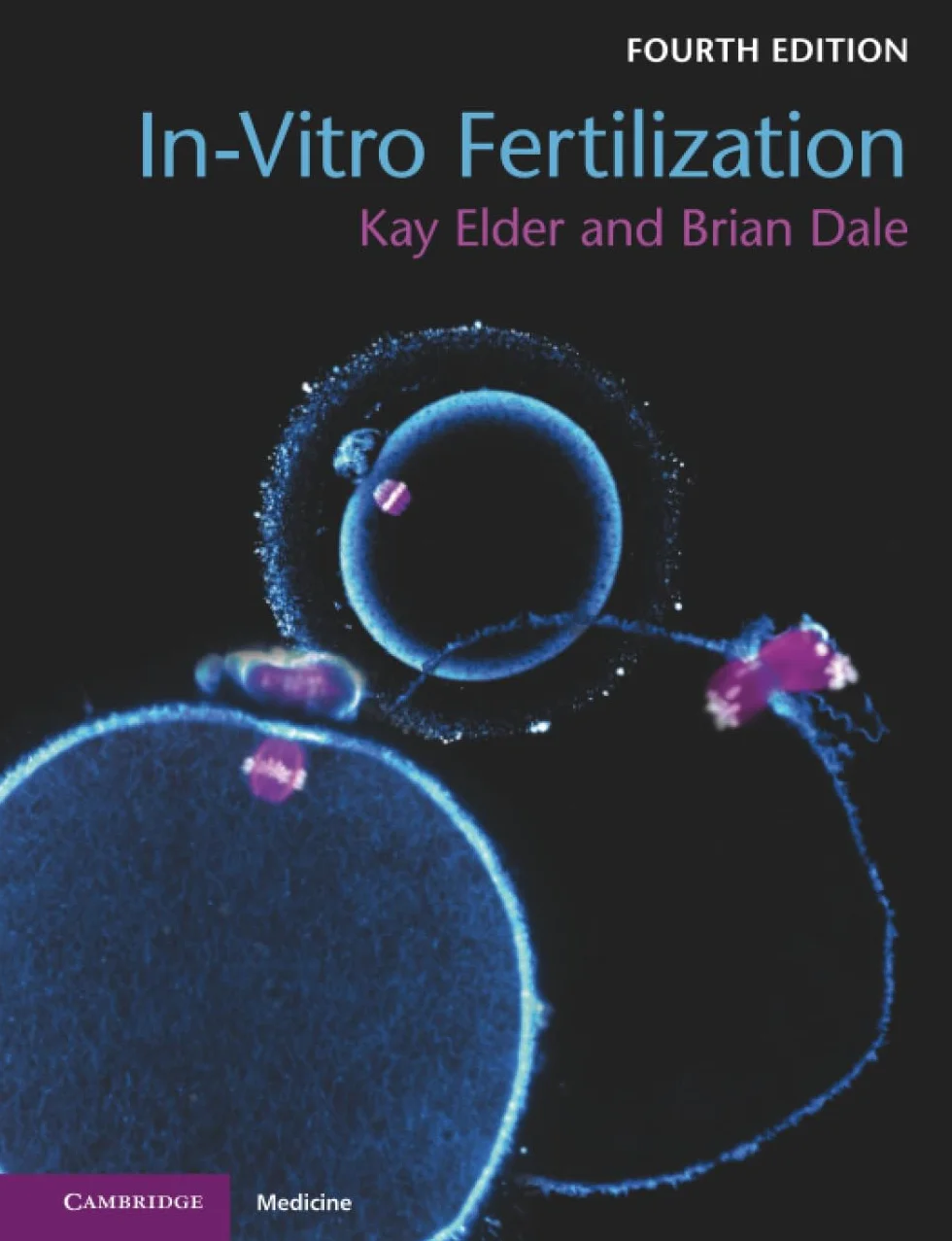 In-Vitro Fertilization