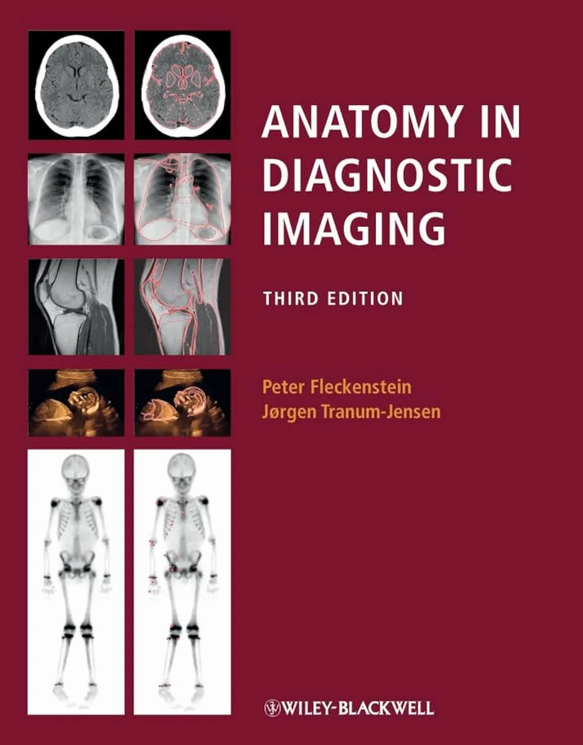 Anatomy in Diagnostic Imaging