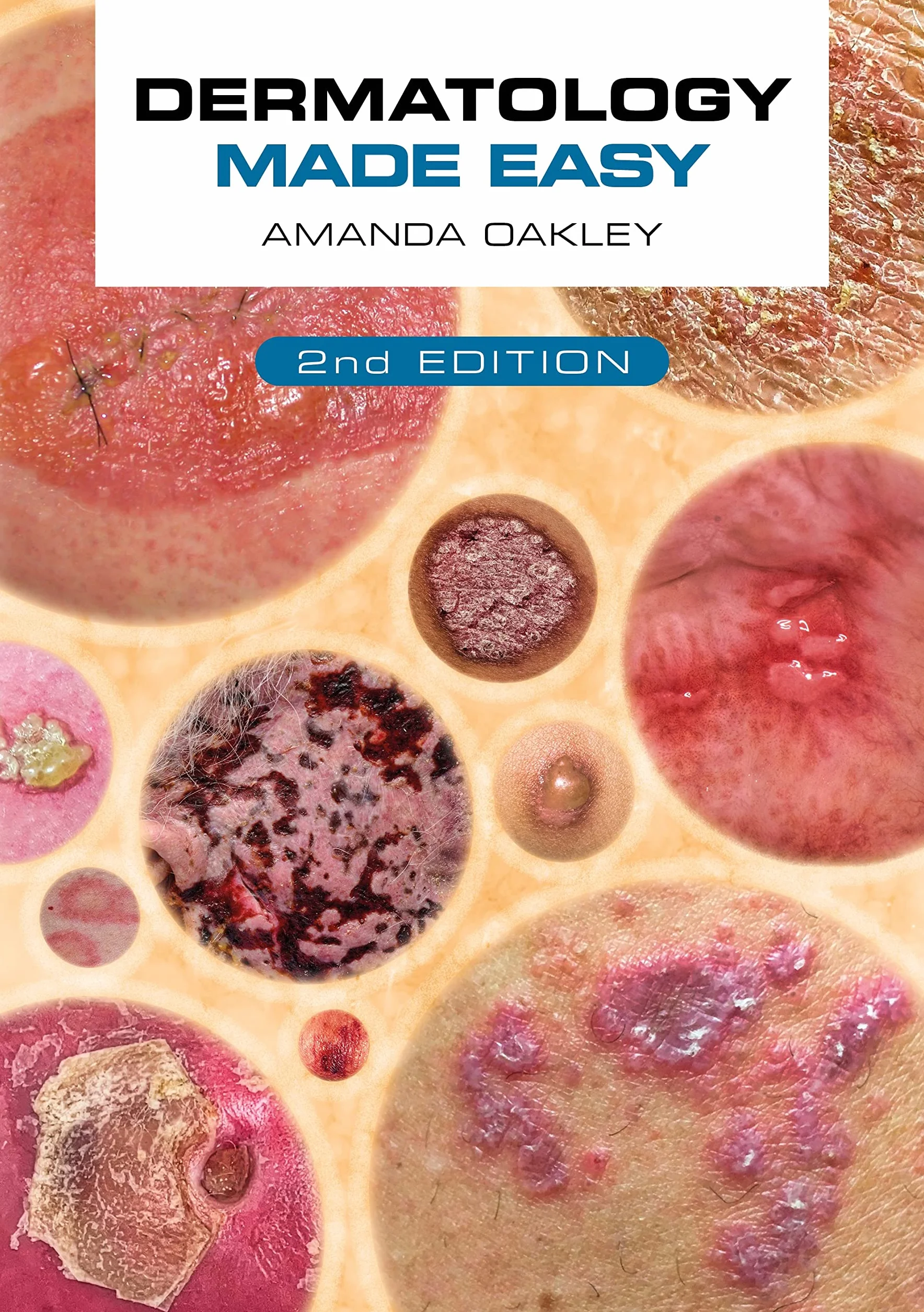 Dermatology Made Easy, Second Edition