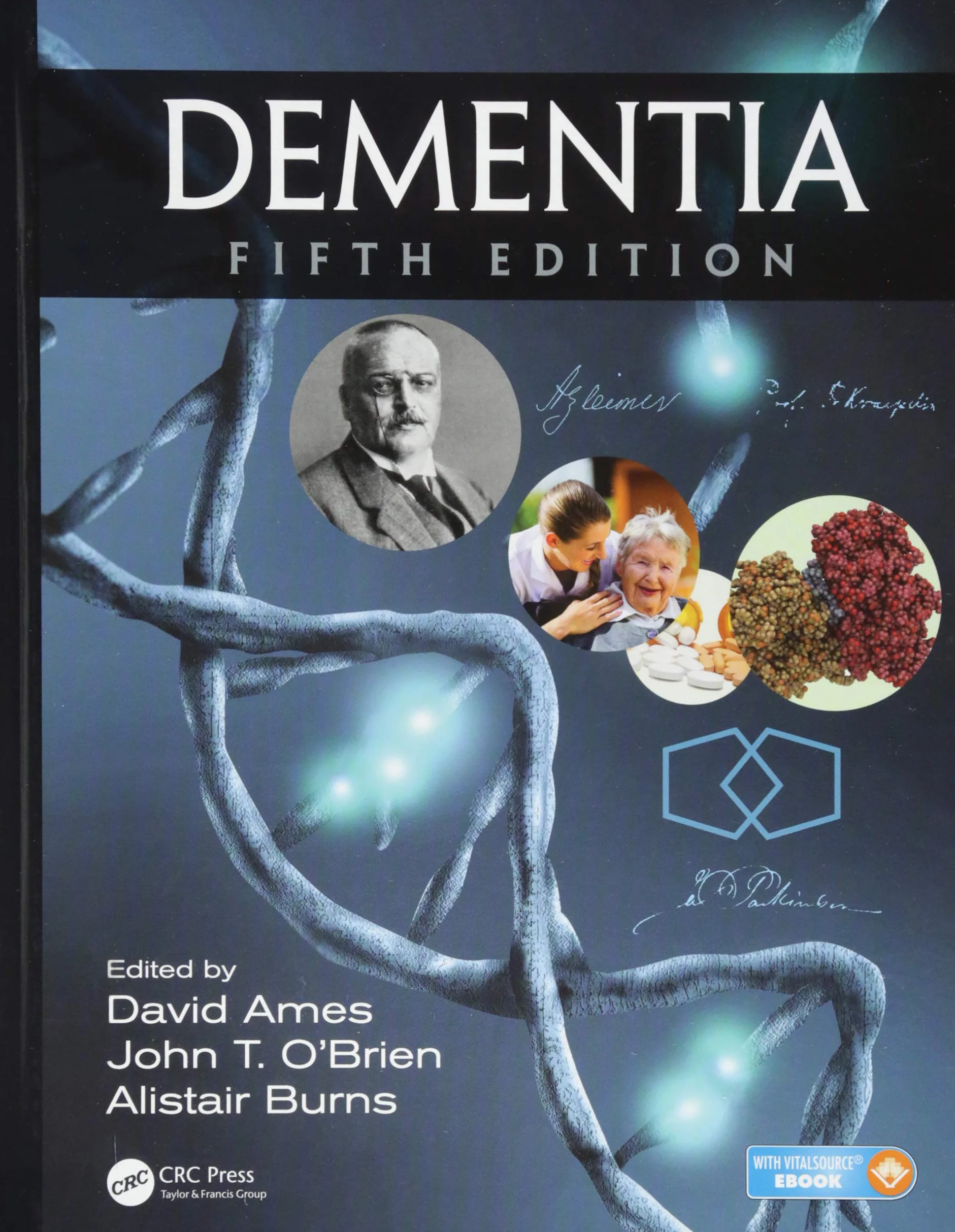 Dementia