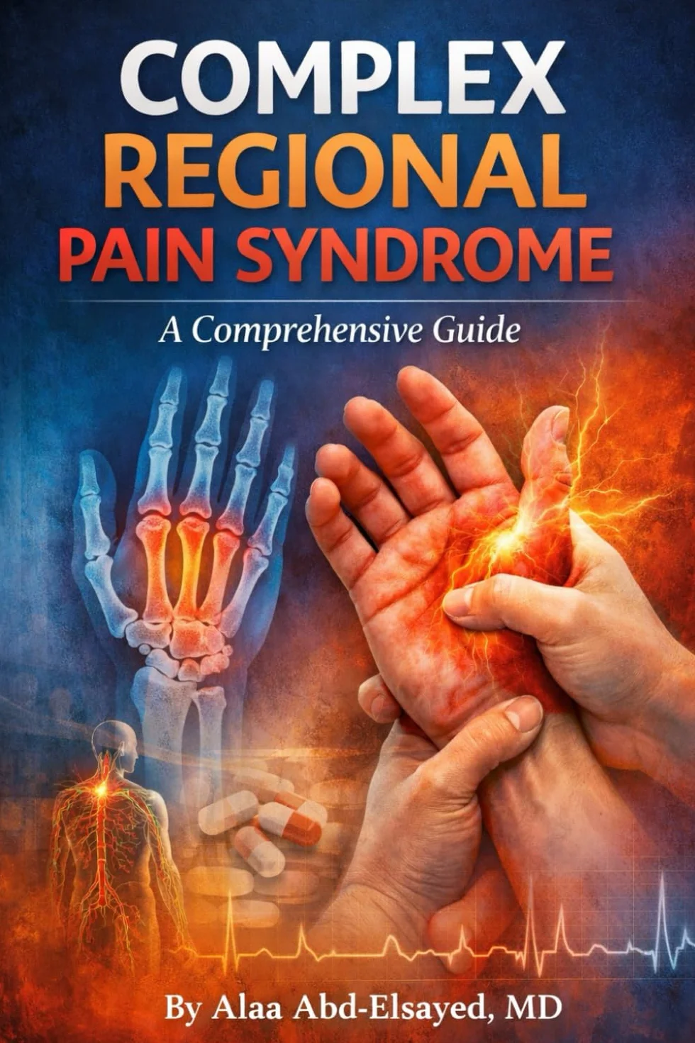 COMPLEX REGIONAL PAIN SYNDROME: A COMPREHENSIVE GUIDE