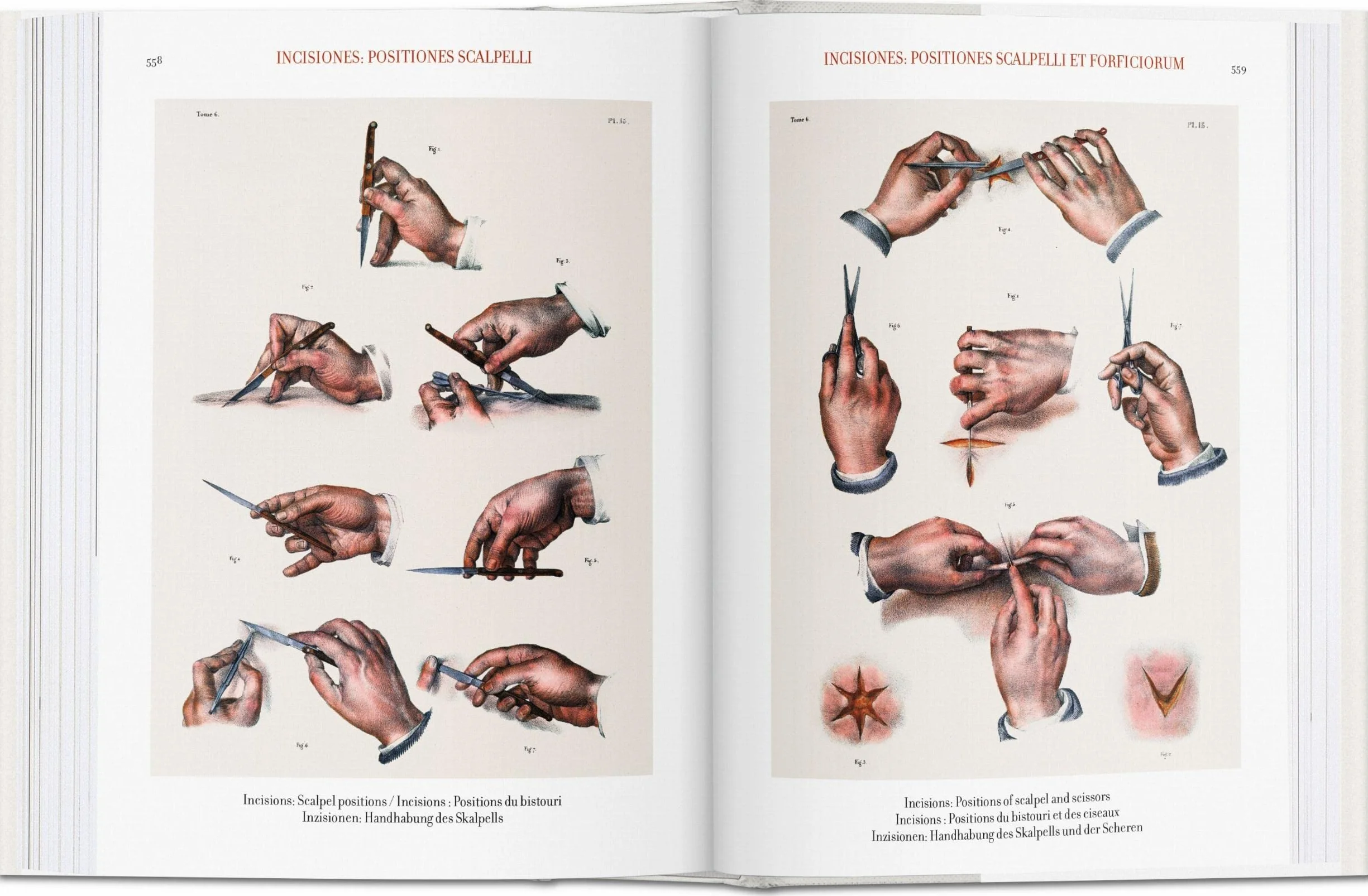 Atlas of Human Anatomy and Surgery