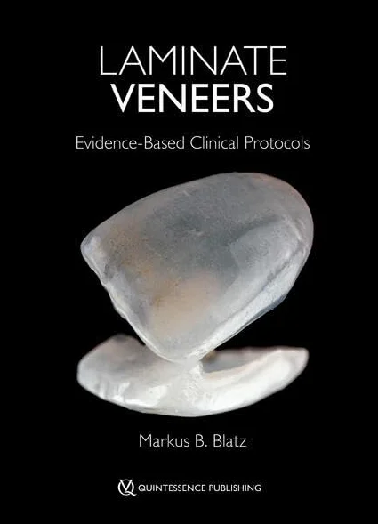 Laminate Veneers: Evidence-Based Clinical Protocols