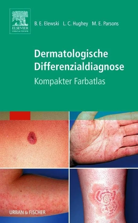 Dermatologische Differenzialdiagnose: Kompakter Farbatlas