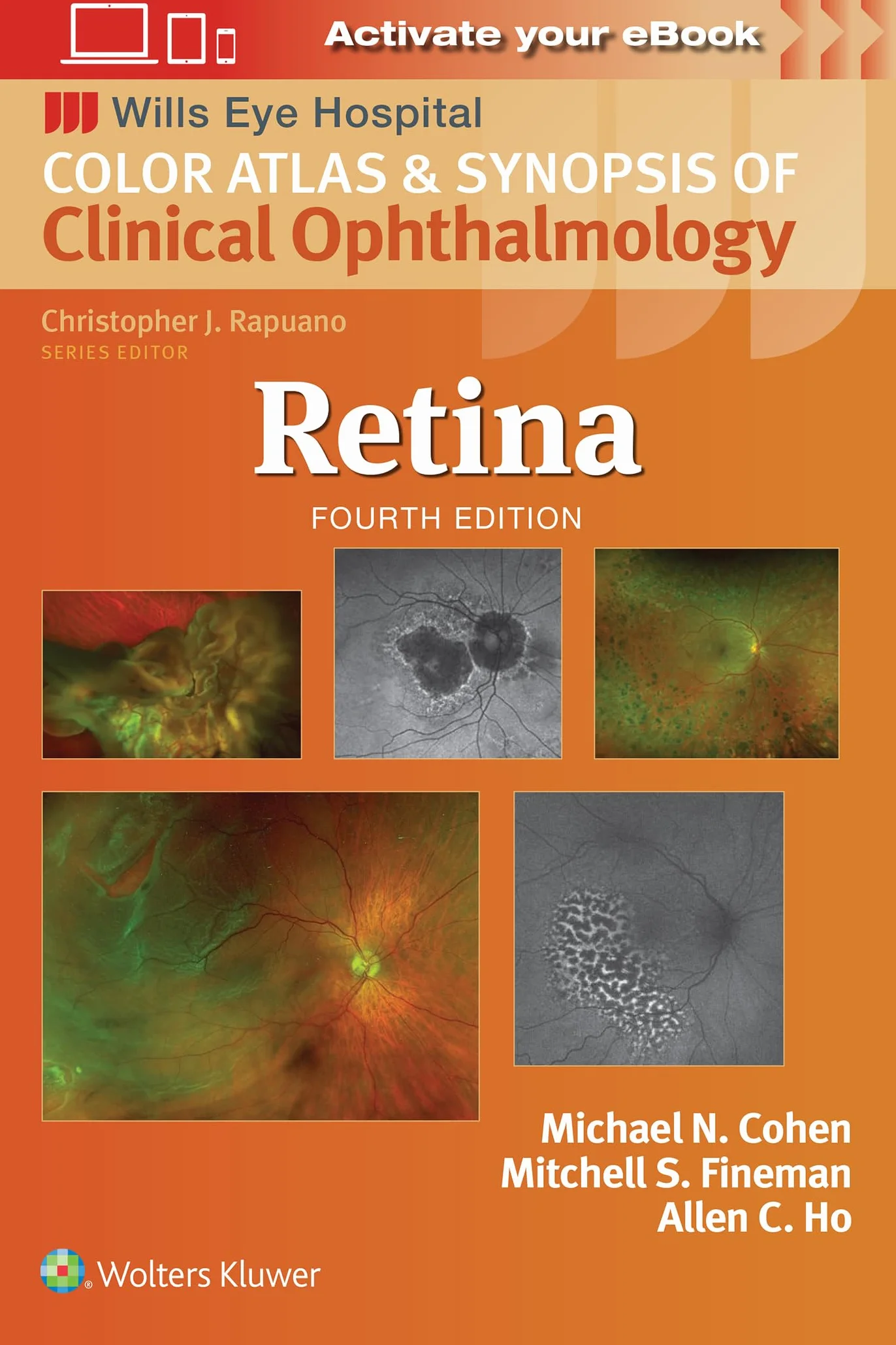 Retina