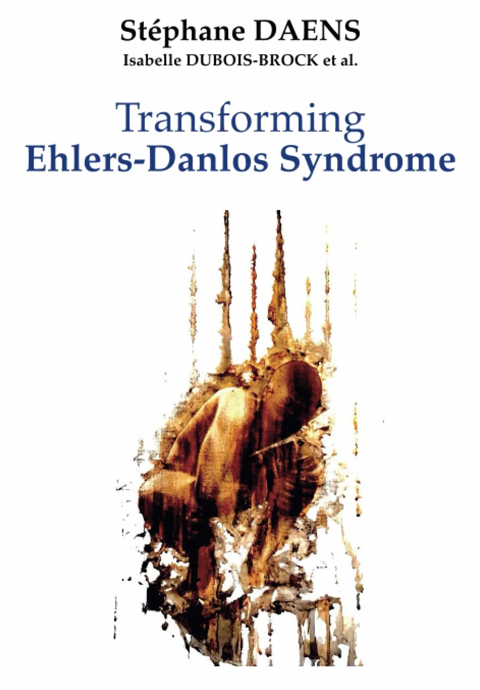 Transforming Ehlers-Danlos Syndrome: A Global Vision of the Disease - The Epigenetic Revolution - Emergencies